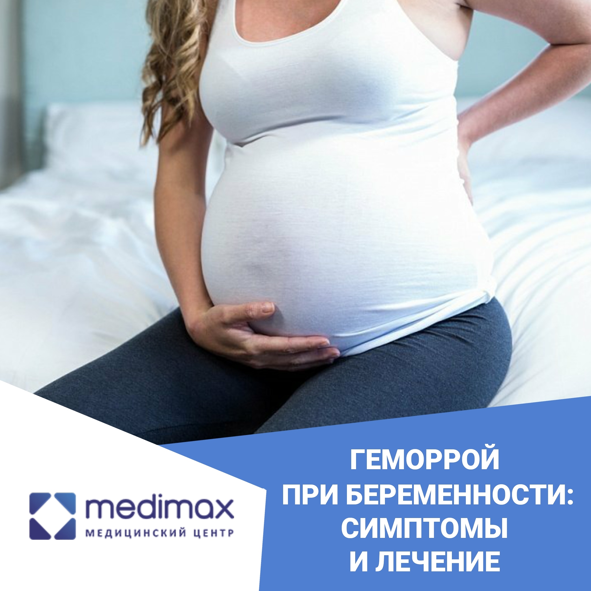 Геморрой при беременности: симптомы и лечение